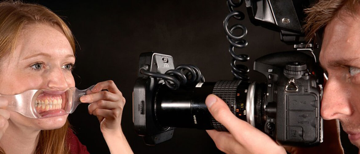 best cameras for dental photography